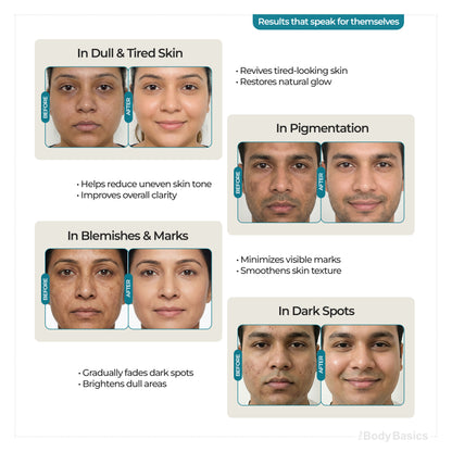 Vitamin C 15% with Ferulic Acid Face Serum For Daily Brightness - 30 ml