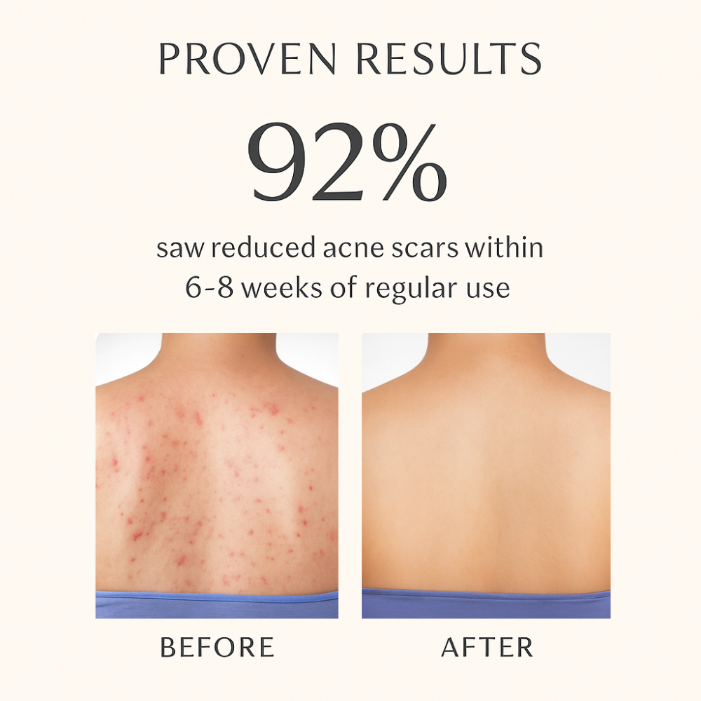 1% Salicylic Acid + 1% Vitamin C Daily Body Wash 200ml – Clear & Bright Skin