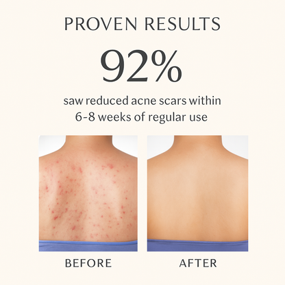 1% Salicylic Acid + 1% Vitamin C Daily Body Wash 200ml – Clear & Bright Skin